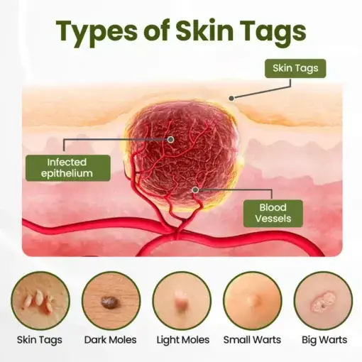 LOVILDS® MagneErase Renewal Cream