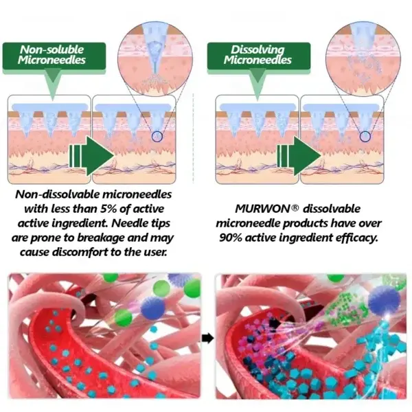 ๐ด๐๐ฅ๐ฆ๐๐ยฎ โ ๐ฉ๐๐๐๐๐ง๐๐ฃ๐ ๐๐๐ฏ๐๐ง๐๐๐ ๐๐๐ฃ๐ค-๐ด๐๐๐๐๐๐๐๐
๐๐ ๐ท๐๐ฉ๐๐ ๐๐๐๐๐ฃ๐ค๐ก๐ค๐๐ฎ