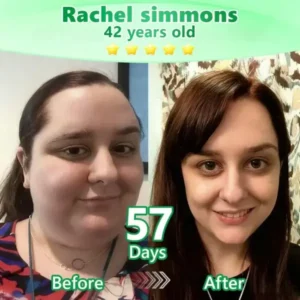 ๐๐ฉ๐๐ซ๐ค๐ฅ๐ฒ๐ซ๐ยฎ ๐ฉ๐๐๐๐ฆ๐ณ๐๐๐ ๐-๐ถ๐ฃ-๐ ๐๐๐๐ ๐๐ช๐ค๐ณ๐ฐ๐ฏ๐ฆ๐ฆ๐ฅ๐ญ๐ฆ ๐ฏ๐๐๐ผ๐