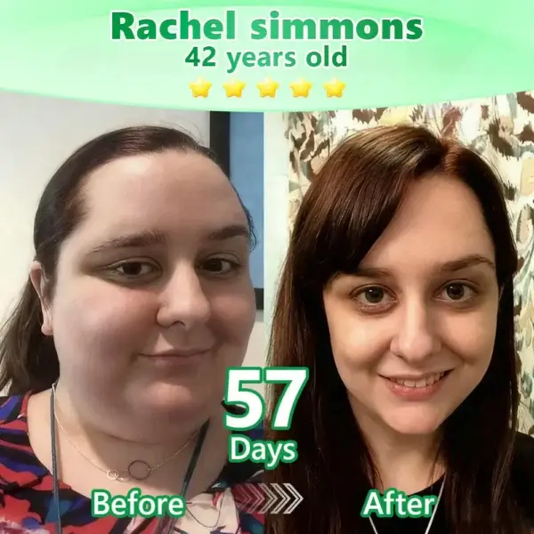 ๐๐ฉ๐๐ซ๐ค๐ฅ๐ฒ๐ซ๐ยฎ ๐ฉ๐๐๐๐ฆ๐ณ๐๐๐ ๐-๐ถ๐ฃ-๐ ๐๐๐๐ ๐๐ช๐ค๐ณ๐ฐ๐ฏ๐ฆ๐ฆ๐ฅ๐ญ๐ฆ ๐ฏ๐๐๐ผ๐