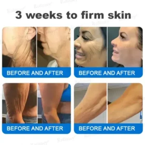 Rolimey® Advanced Firming & Wrinkle-Reducing Cream