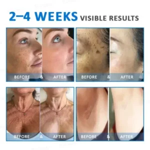 Rolimey® Advanced Firming & Wrinkle-Reducing Cream