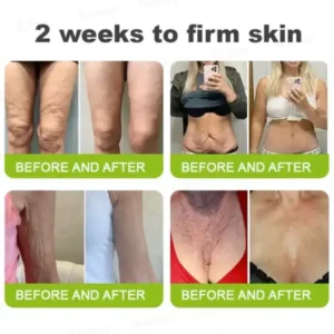 Rolimey® Botox & Vita-A Retinol Shot Tightening and Wrinkle-Reducing Cream