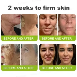 Rolimey® Botox & Vita-A Retinol Shot Tightening and Wrinkle-Reducing Cream