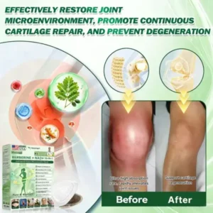 𝗙𝗗𝐀-𝐑𝐞𝗴𝗶𝘀𝘁𝐞𝐫𝐞𝗱 & 𝐆𝗠𝐏 𝗖𝗲𝗿𝐭𝐢𝐟𝐢𝐞𝗱👩‍⚕️✨ | 🇺🇸 𝐇𝐞𝐚𝐥𝐫𝐢𝐳𝐞® 𝙈𝒐𝒓𝒊𝒏𝒈𝗮 · 𝗕𝗲𝗿𝗯𝐞𝐫𝐢𝐧𝙚 × 𝙉𝑨𝑫+ 𝟏𝟎-𝙞𝙣-𝟏 𝘼𝒅𝒗𝒂𝒏𝒄𝒆𝐝 𝐍𝐚𝐧𝙤 𝙈𝙞𝙘𝙧𝙤𝙣𝒆𝒆𝒅𝒍𝐞 𝐏𝐚𝐭𝙘𝙝