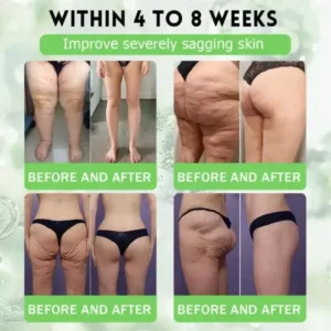 Genayu®️ MORINGA+BERBERINE Advenaced Nano Microneedle Patch