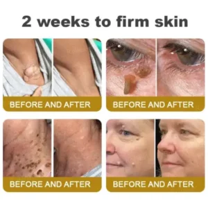 Rolimey® Botox Bee Venom Skin Treatment Cream