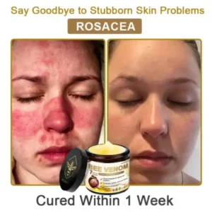 Rolimey® Botox Bee Venom Skin Treatment Cream